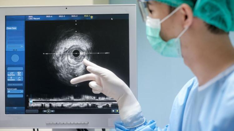 A doctor wearing blue scrubs and white gloves pointing to a screen showing the inside of a patient's arteries. 