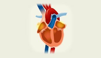 Atrial Fibrillation (AFib) video
