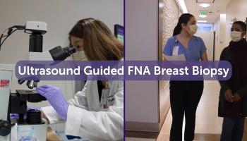 Ultrasound Guided FNA Breast Biopsy video
